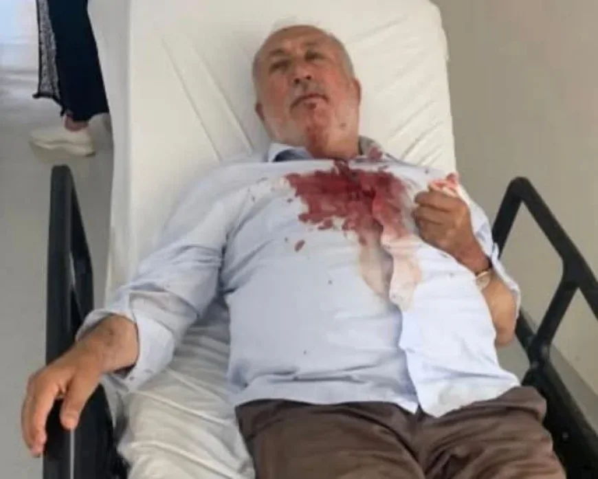 Vekil Alagöz Iğdır’da Din Âlimi Tümay’a Yapılan Saldırıyı Kınadı