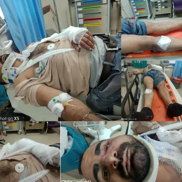Iğdır’da Sokak Ortasında Darp Edilmiş Bir Kişi Bulundu: Her İki Kolu Kırıldı